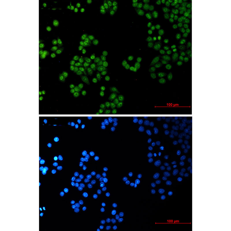 SP1 Rabbit mAb