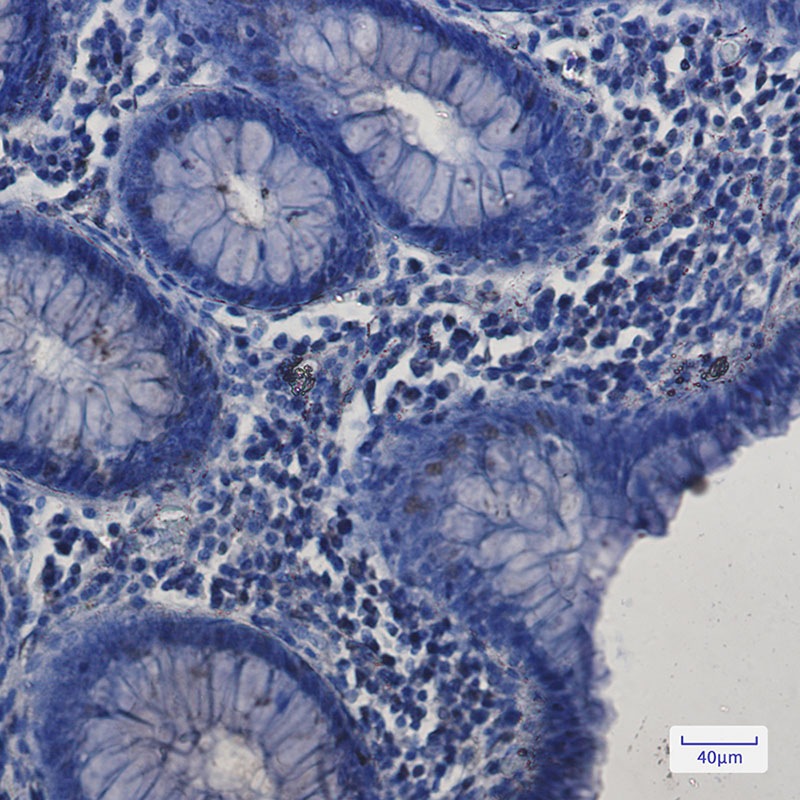 SP1 Rabbit mAb