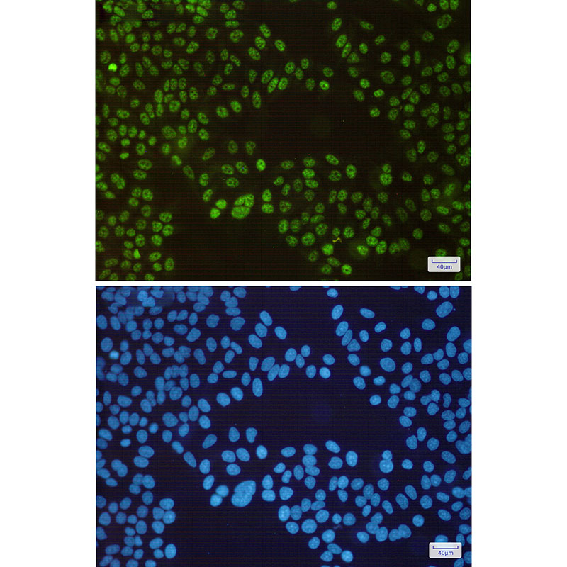 SP1 Rabbit mAb