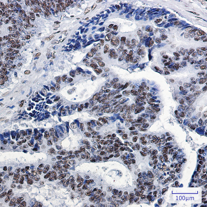 SP1 Rabbit mAb