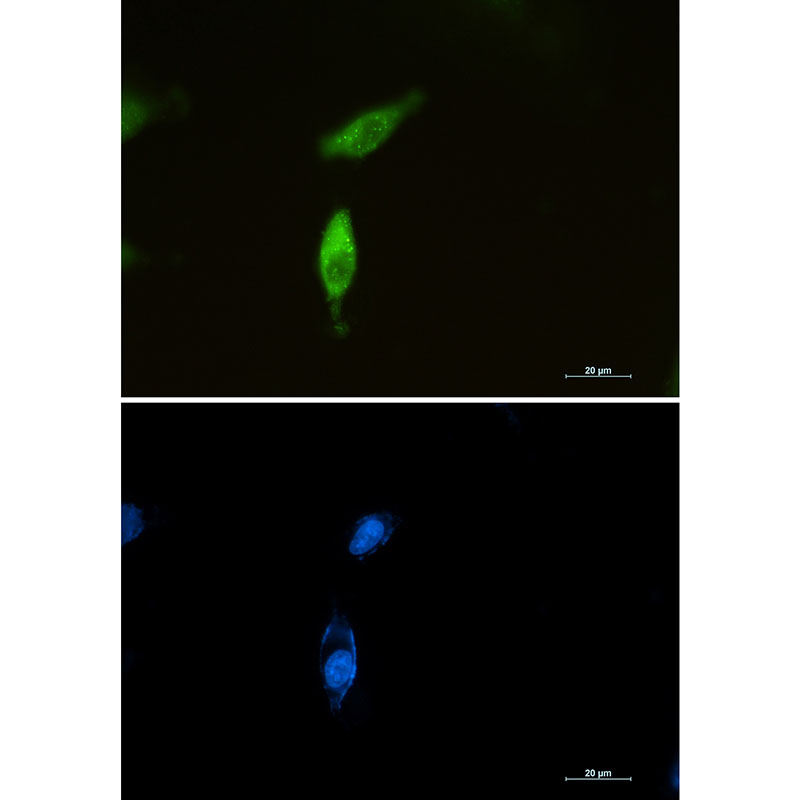 SQSTM1/p62 Rabbit mAb