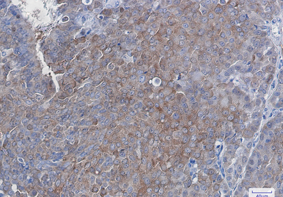 SQSTM1/p62 Rabbit mAb