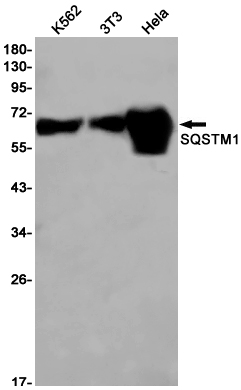 SQSTM1/p62 Rabbit mAb