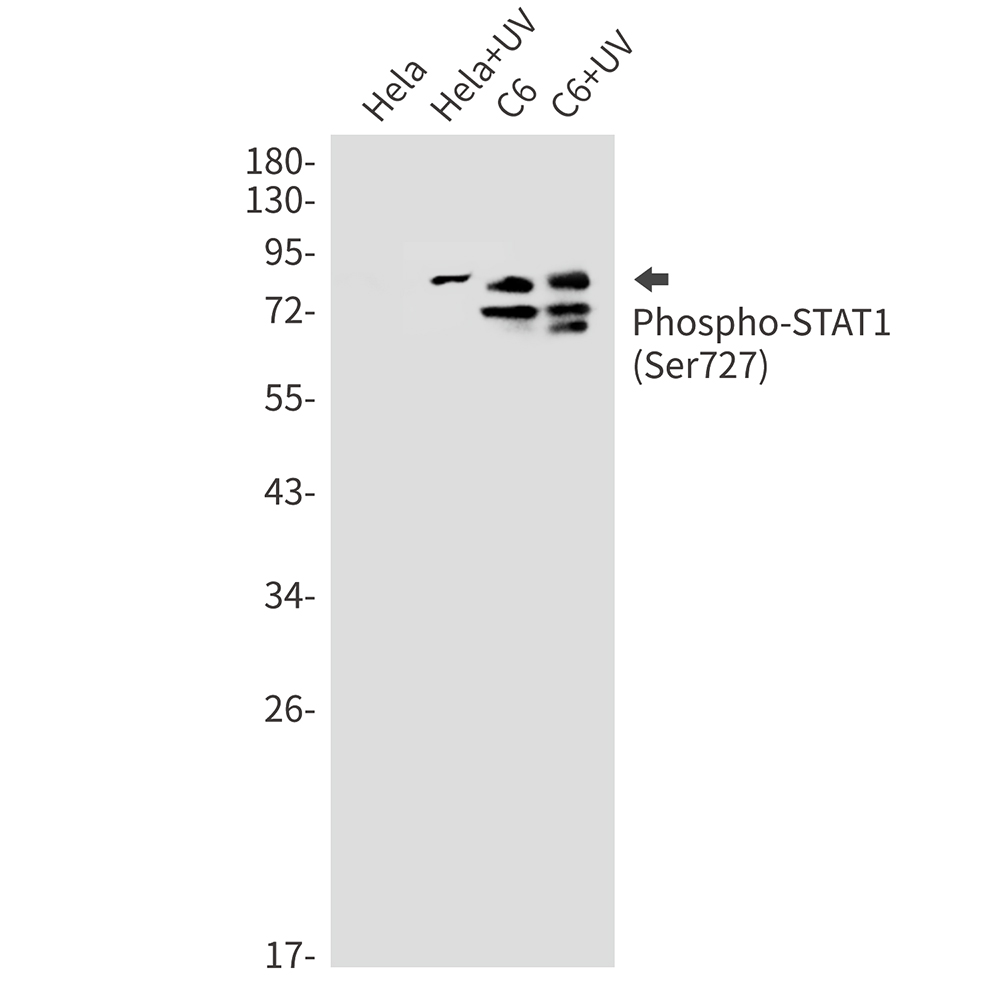 Phospho-STAT1 (Ser727) Rabbit mAb