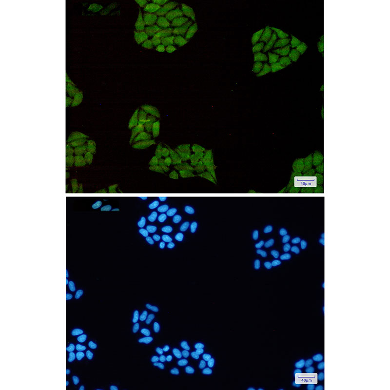 STAT1 Rabbit mAb