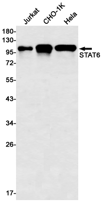 STAT6 Rabbit mAb