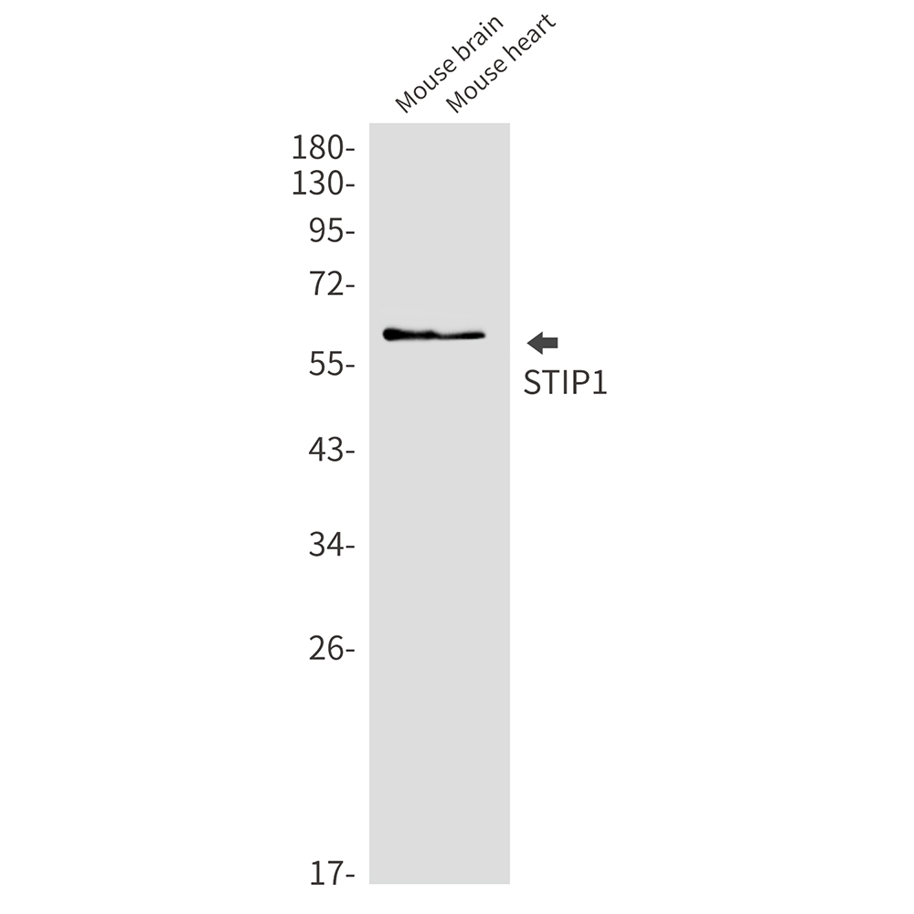 STIP1 Rabbit mAb