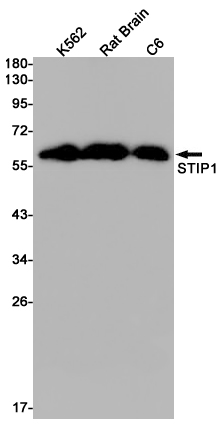 STIP1 Rabbit mAb