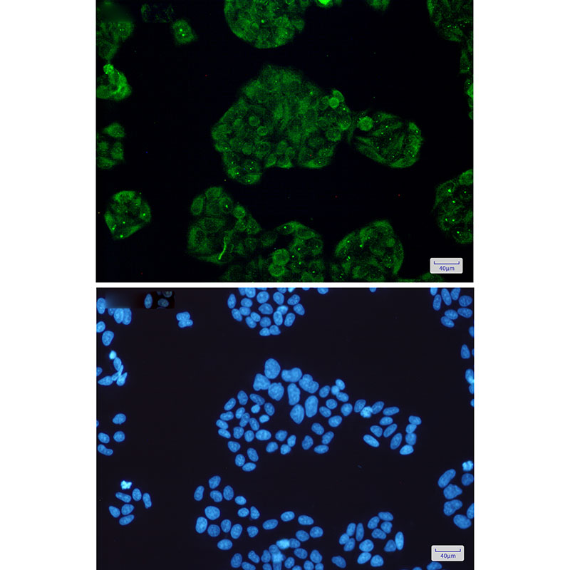 STUB1 Rabbit mAb