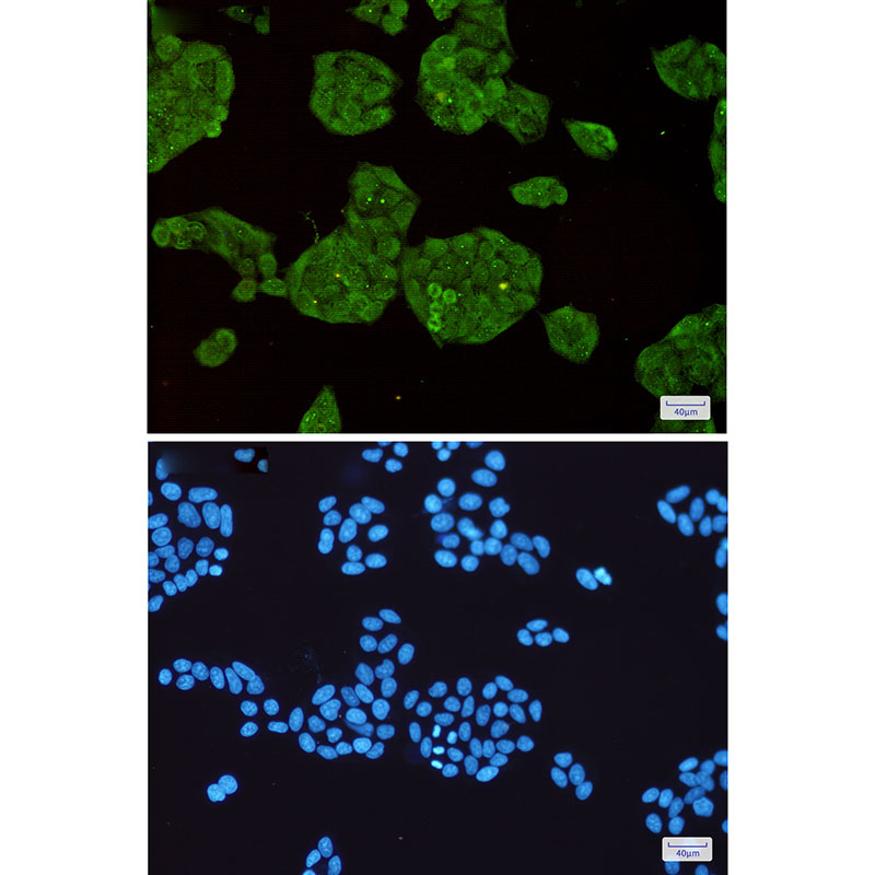 STUB1 Rabbit mAb