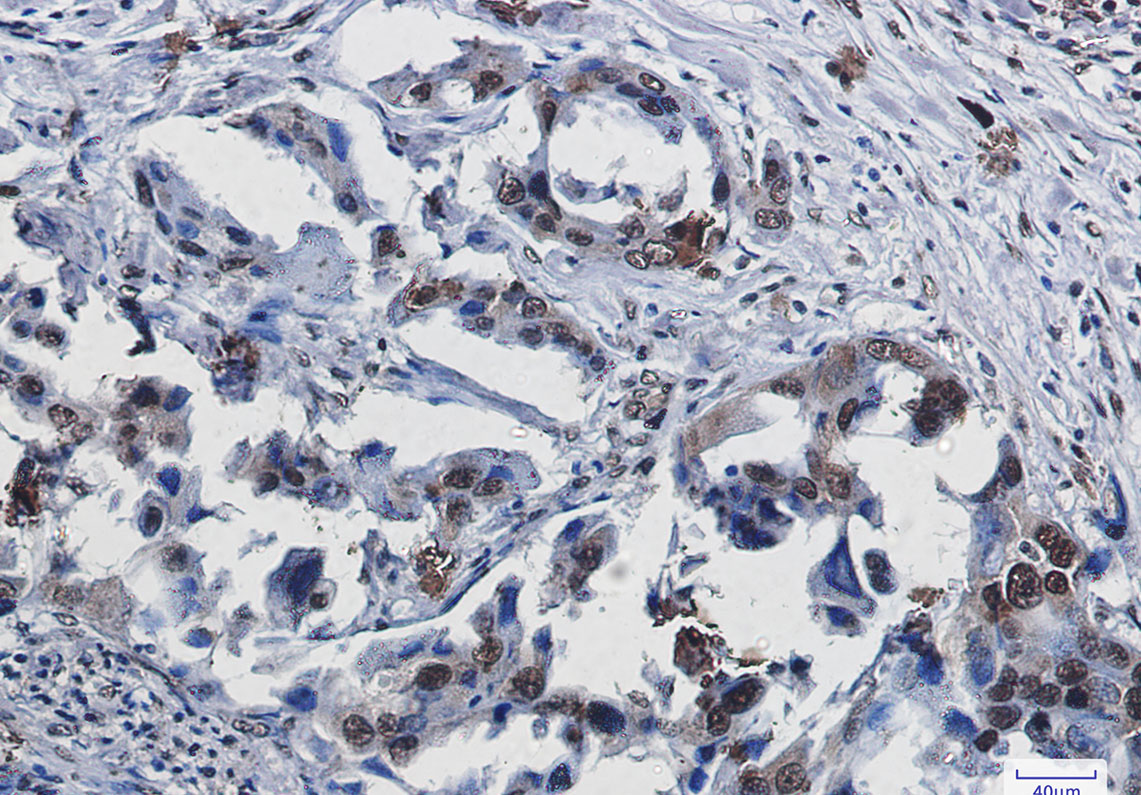 SUMO1 Rabbit mAb