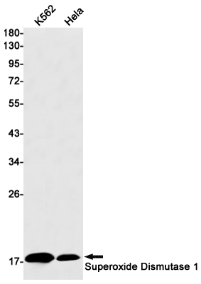 Superoxide Dismutase 1 Rabbit mAb