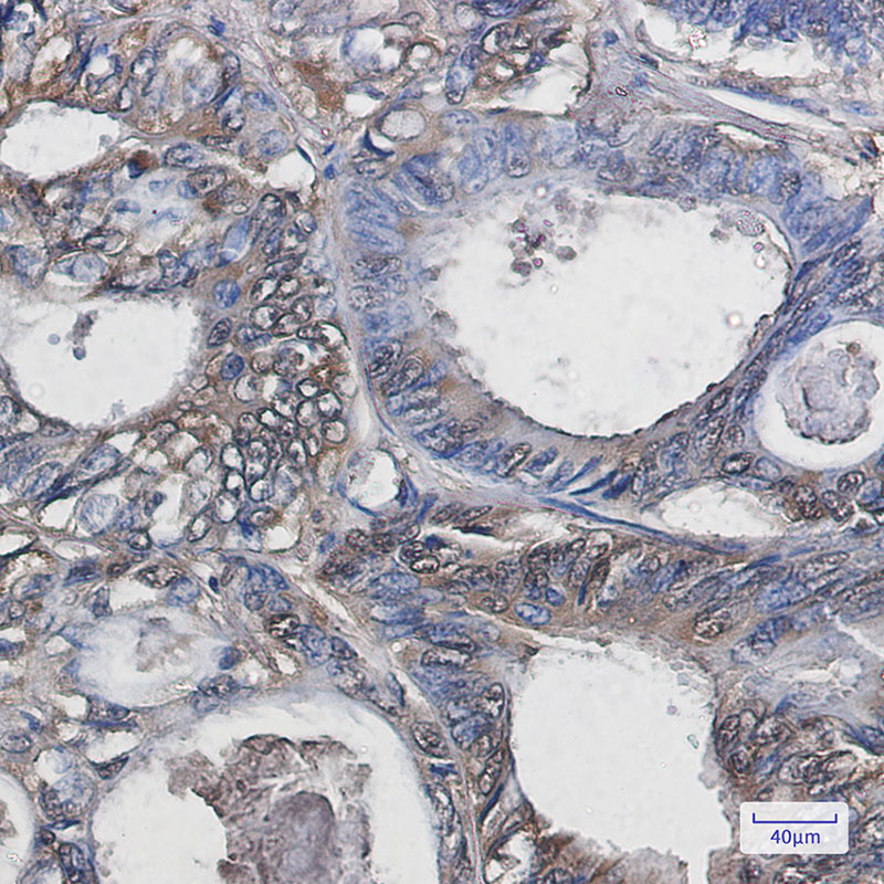 Superoxide Dismutase 1 Rabbit mAb