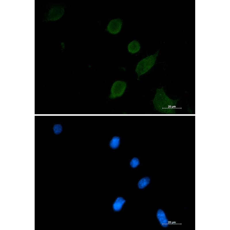 Synaptophysin Rabbit mAb