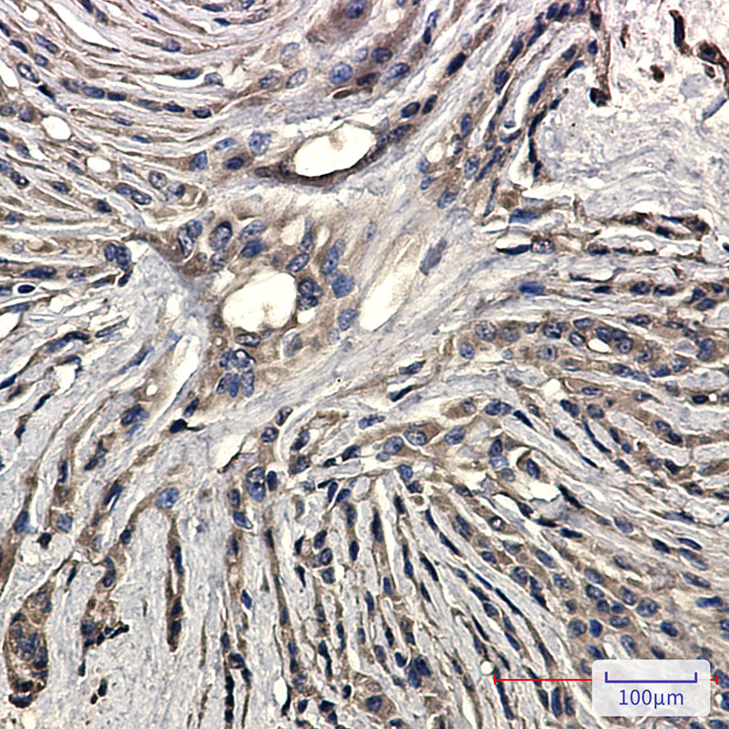 Synaptophysin Rabbit mAb