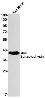 Synaptophysin Rabbit mAb