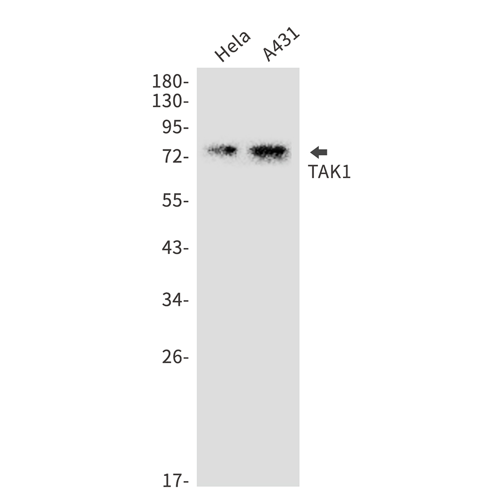 TAK1 Rabbit mAb