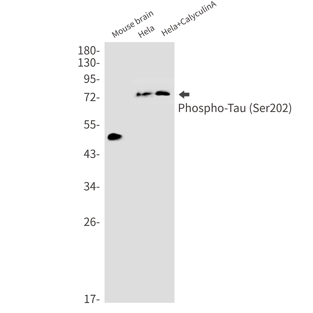 Phospho-Tau (Ser202) Rabbit mAb