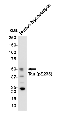 Phospho-Tau (Ser235) Rabbit mAb