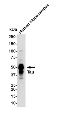 Phospho-Tau (Thr50) Rabbit mAb