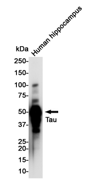 Tau Rabbit mAb