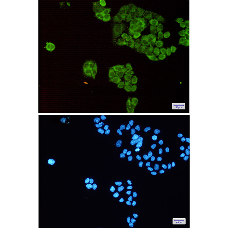 TCTP Rabbit mAb