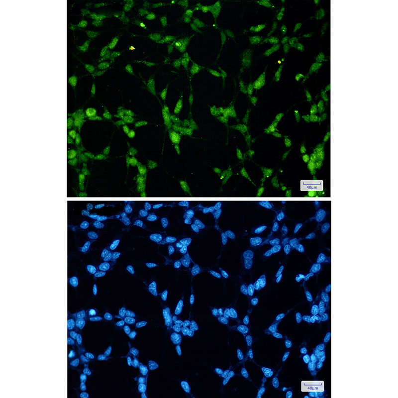 TDP 43 Rabbit mAb