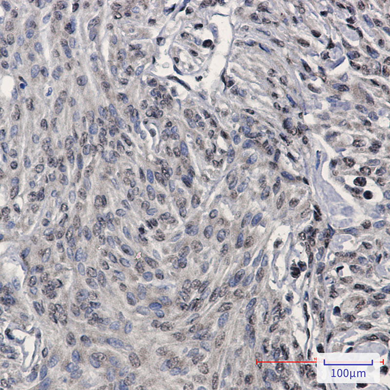 TDP 43 Rabbit mAb