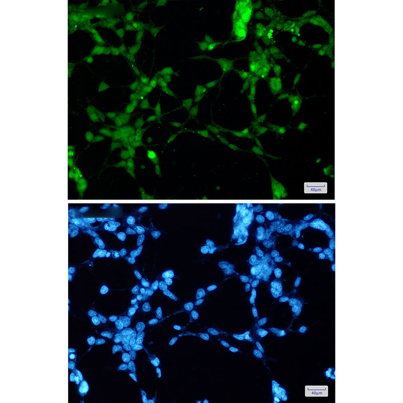 TDP 43 Rabbit mAb