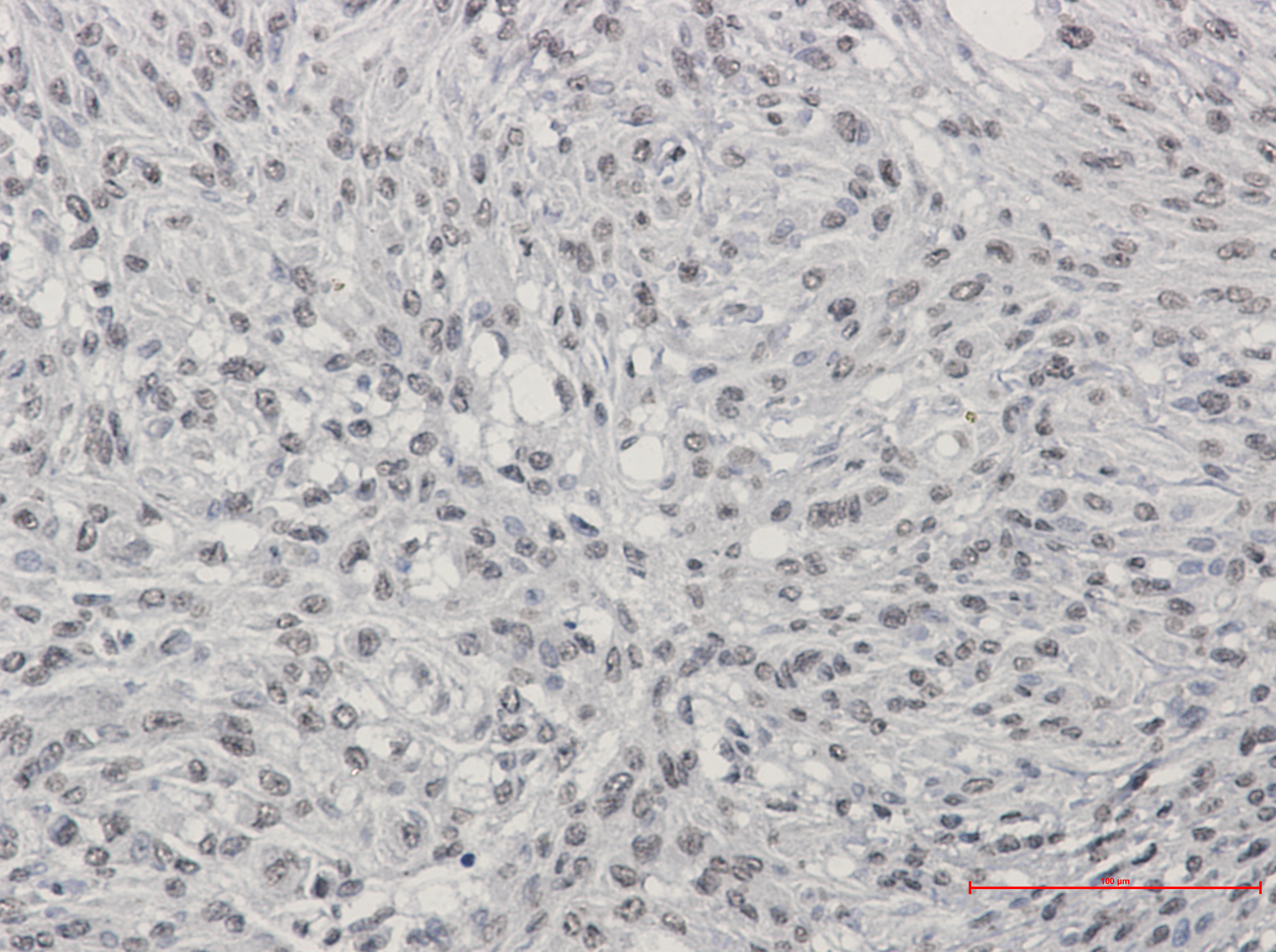 TDP 43 Rabbit mAb