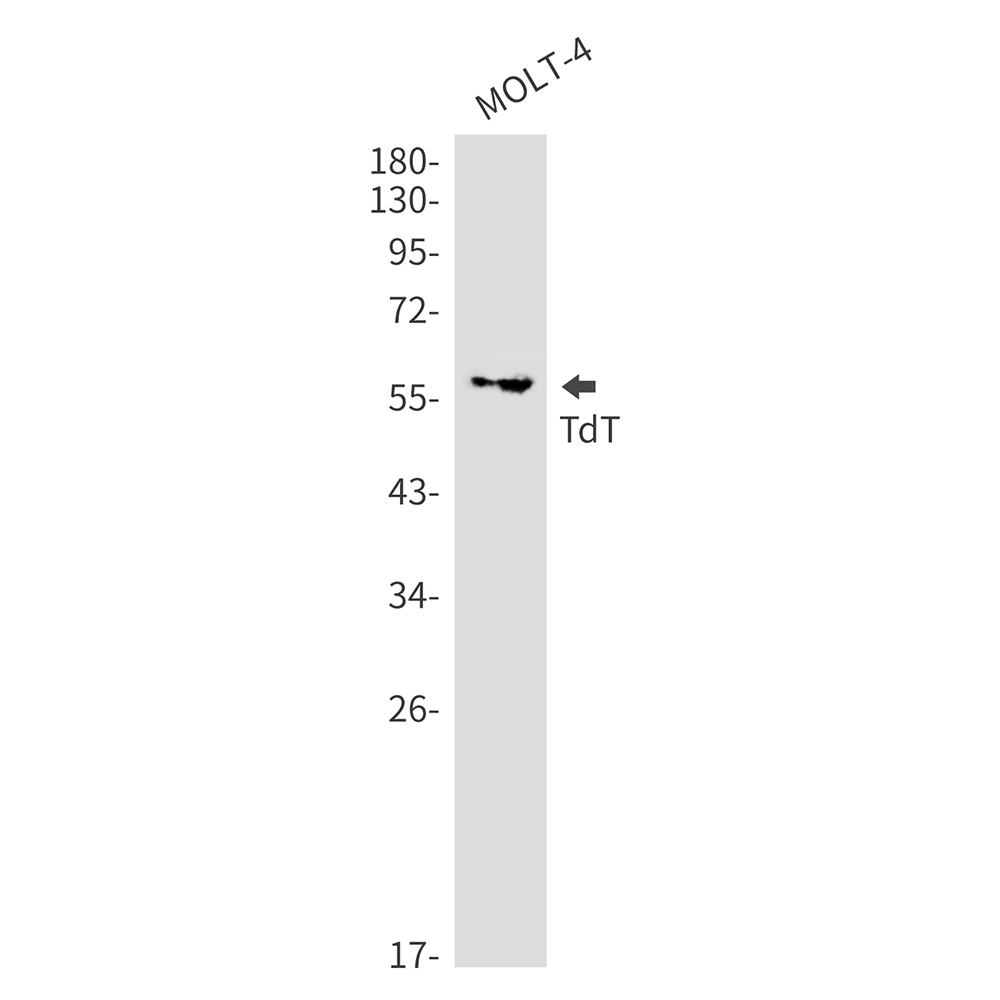 DNA Nucleotidylexotransferase Rabbit mAb