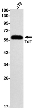 DNA Nucleotidylexotransferase Rabbit mAb