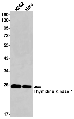 Thymidine Kinase Rabbit mAb