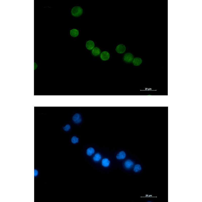 Thymidylate Synthase Rabbit mAb