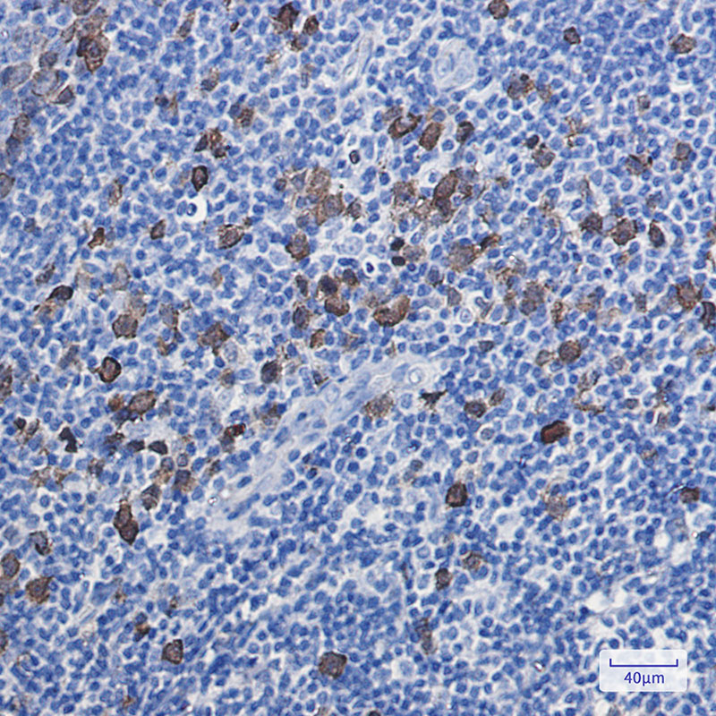 Thymidylate Synthase Rabbit mAb