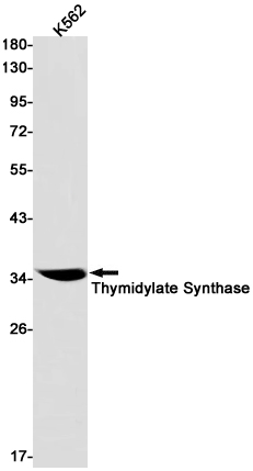 Thymidylate Synthase Rabbit mAb