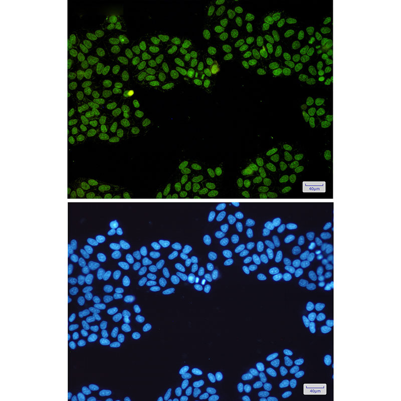 Topoisomerase I Rabbit mAb