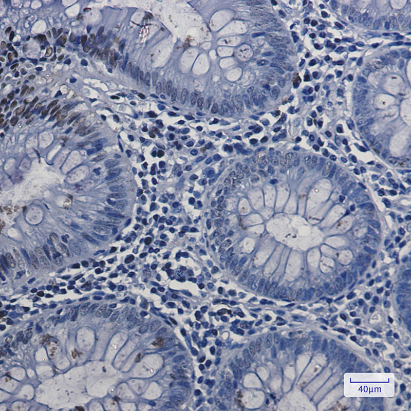 Topoisomerase I Rabbit mAb