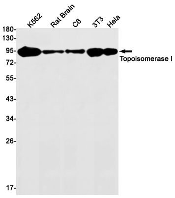 Topoisomerase I Rabbit mAb