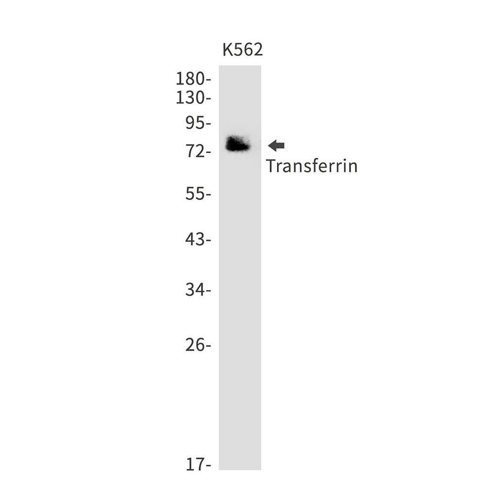 Transferrin Rabbit mAb