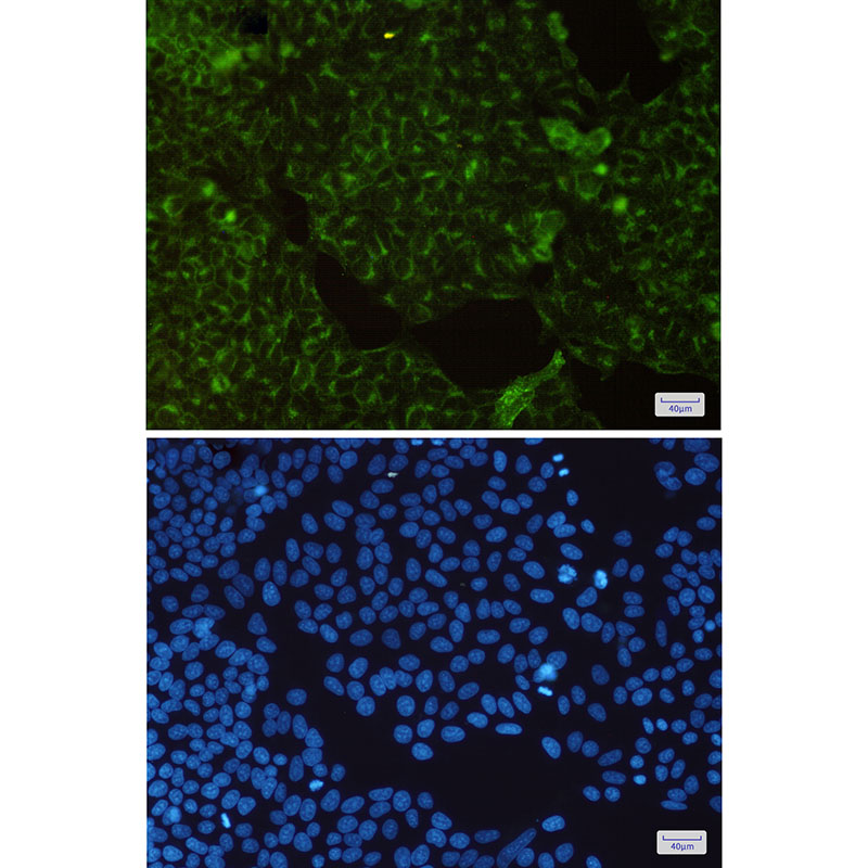 Transferrin Receptor 1 Rabbit mAb