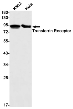 Transferrin Receptor 1 Rabbit mAb