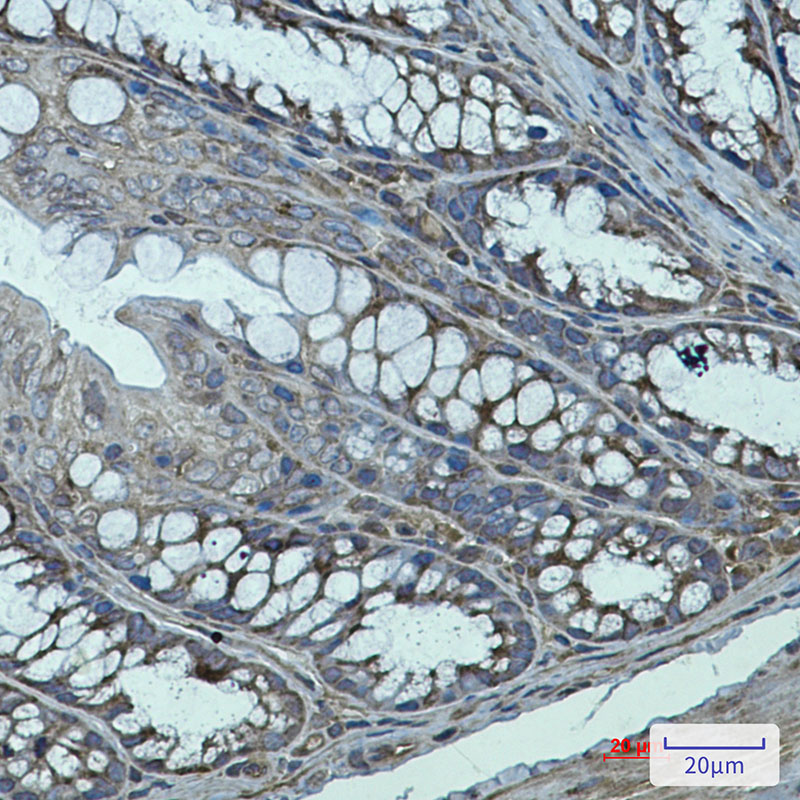 Transglutaminase 2 Rabbit mAb