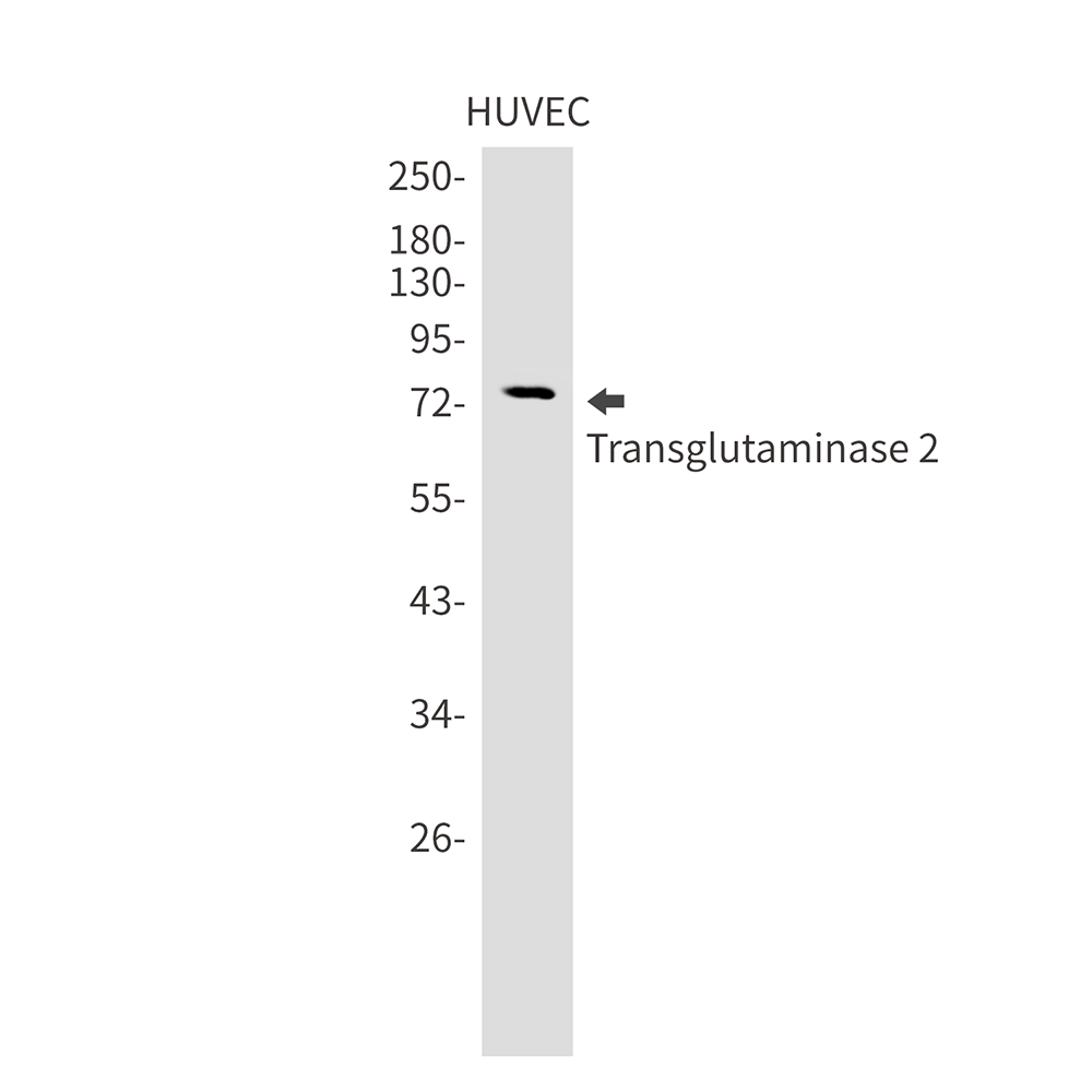 Transglutaminase 2 Rabbit mAb