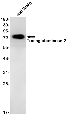 Transglutaminase 2 Rabbit mAb