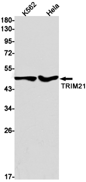 TRIM21 Rabbit mAb