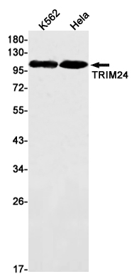 TRIM24 Rabbit mAb