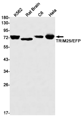 TRIM25 Rabbit mAb