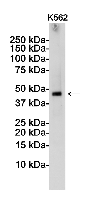 TSG101 Rabbit mAb