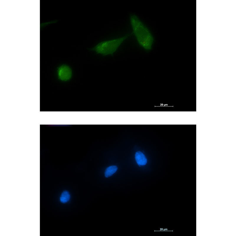 TSG101 Rabbit mAb